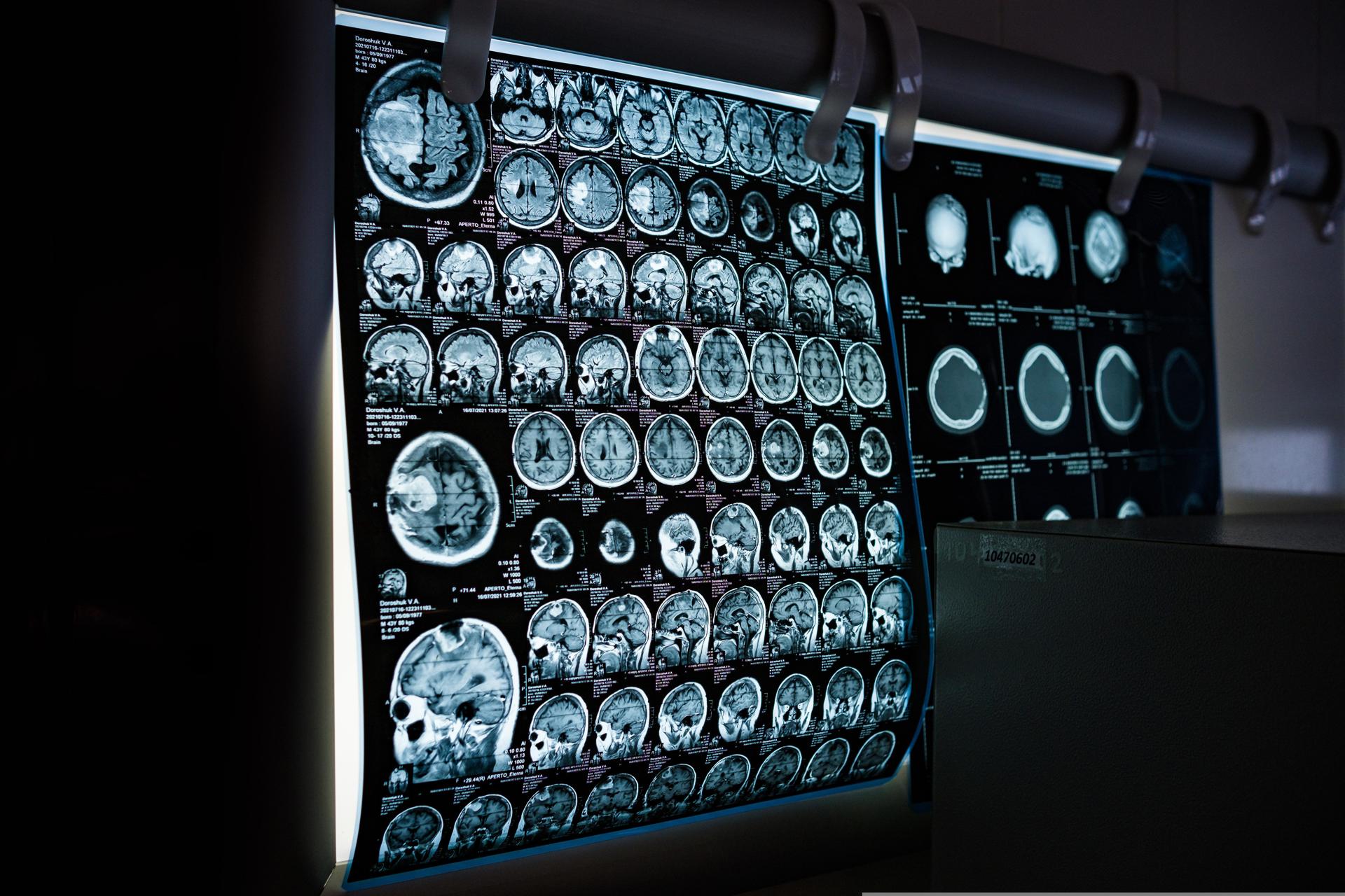 Photograph of brain scans on a light up board